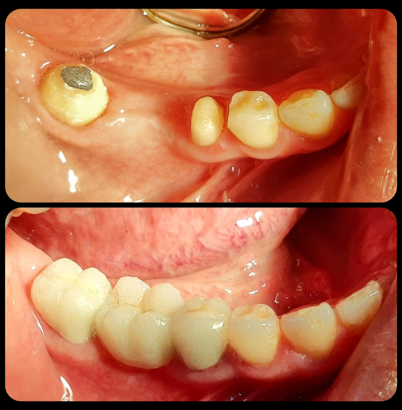 Consultorio Dental Acapulco dr Saudi