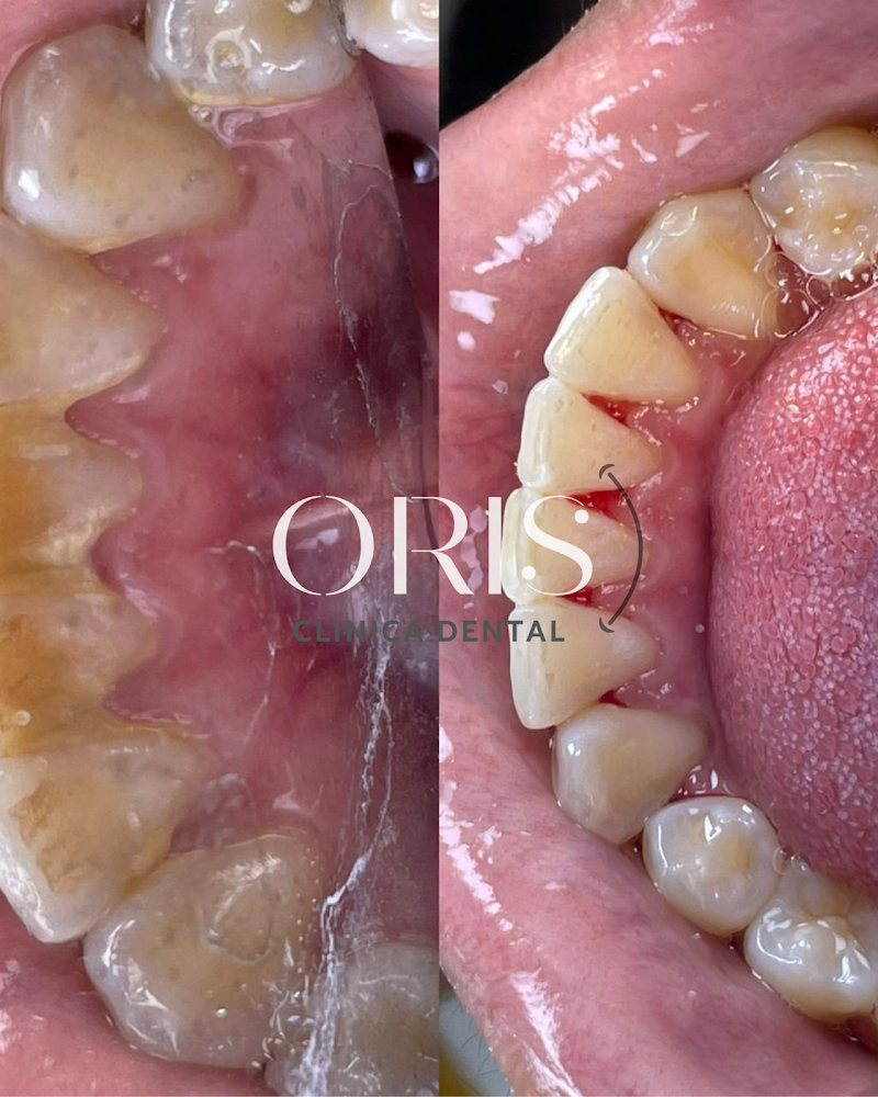 CLINICA DENTAL ORIS ACAPULCO