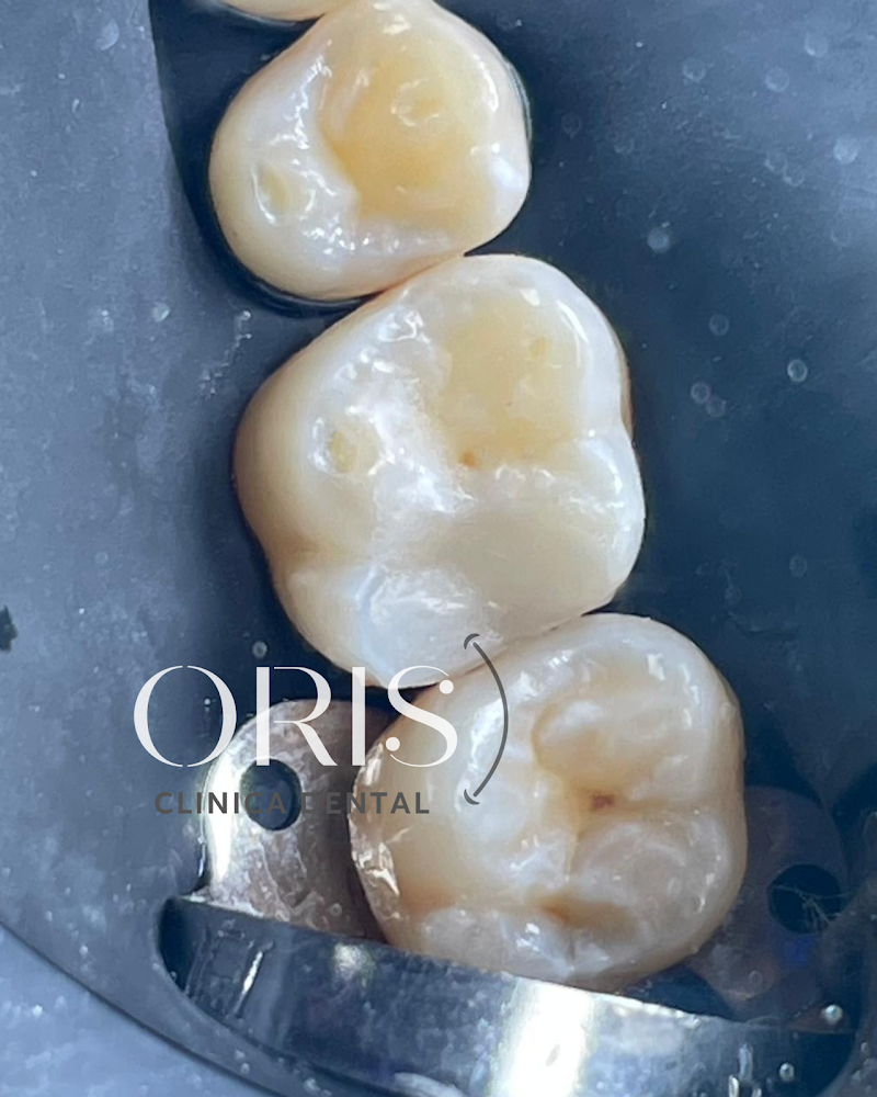 CLINICA DENTAL ORIS ACAPULCO