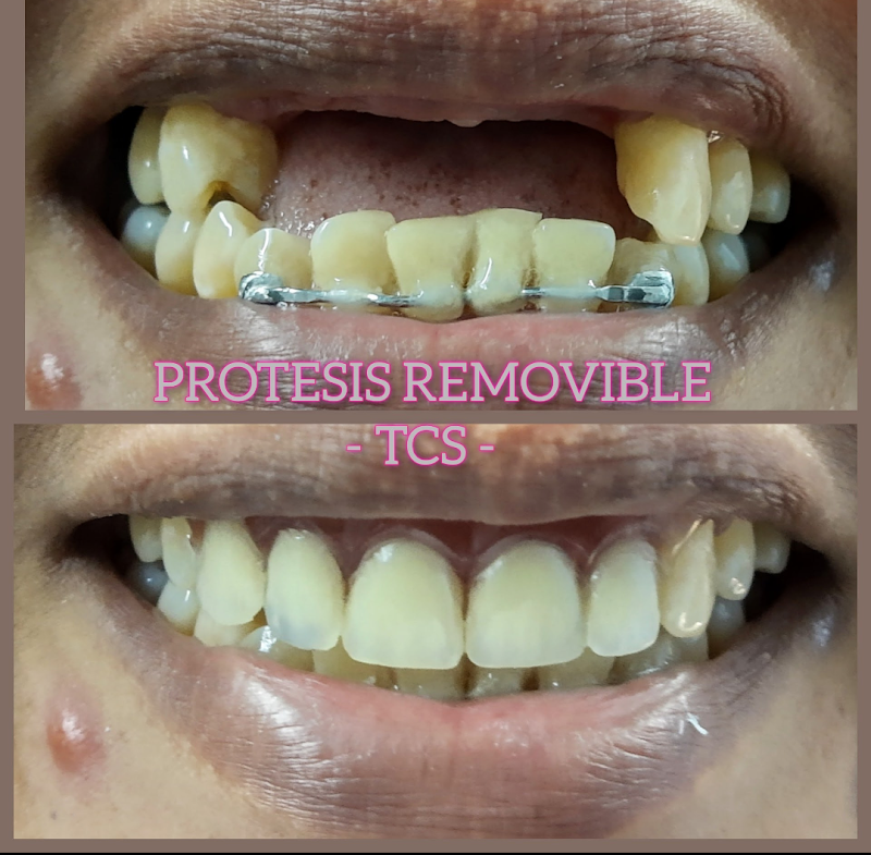 Consultorio Dental Acapulco dr Saudi